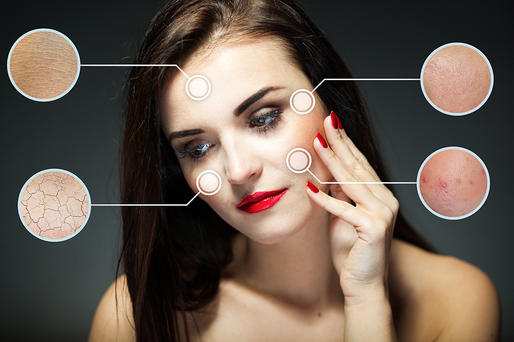 Imagem de mulher de batom vermelho tocando o rosto com edição gráfica para dar zoom em marcas de acne, expressão e manchas. Imagem utilizada para ilustrar conteúdo sobre dermoabrasão.